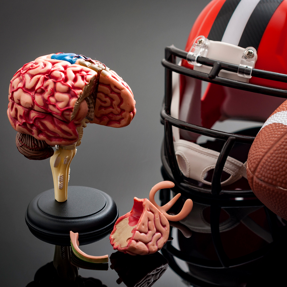 Highlights from Brain Injury Workshop
