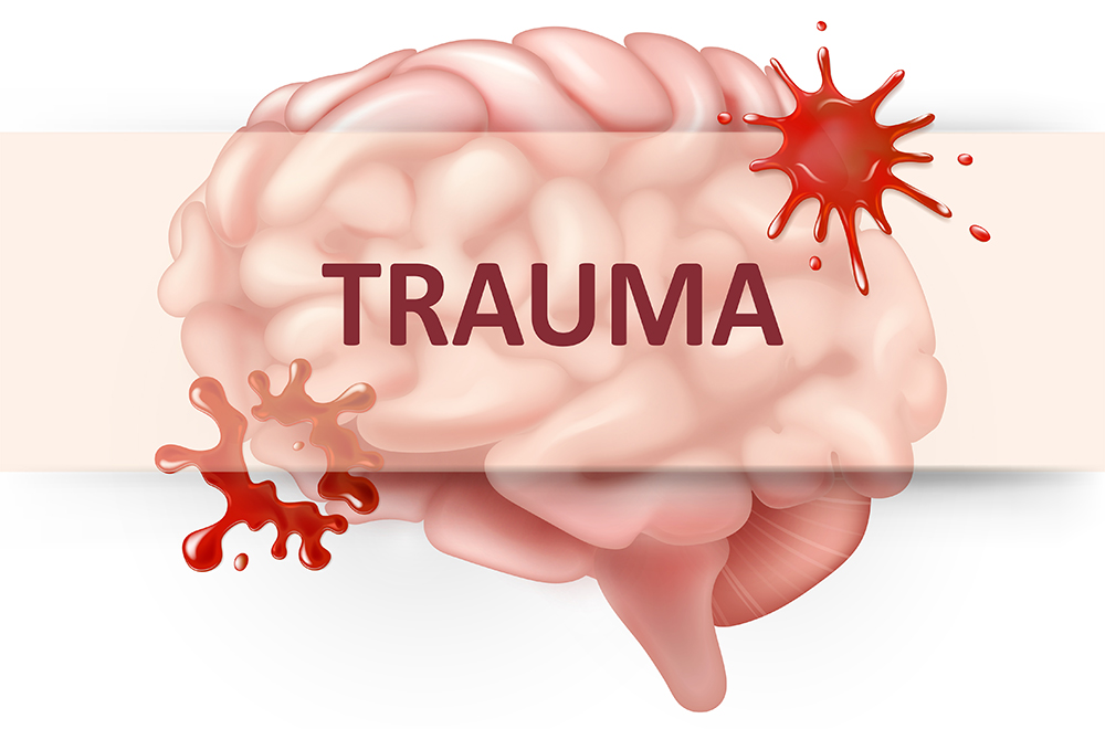 Brain trauma FINAL