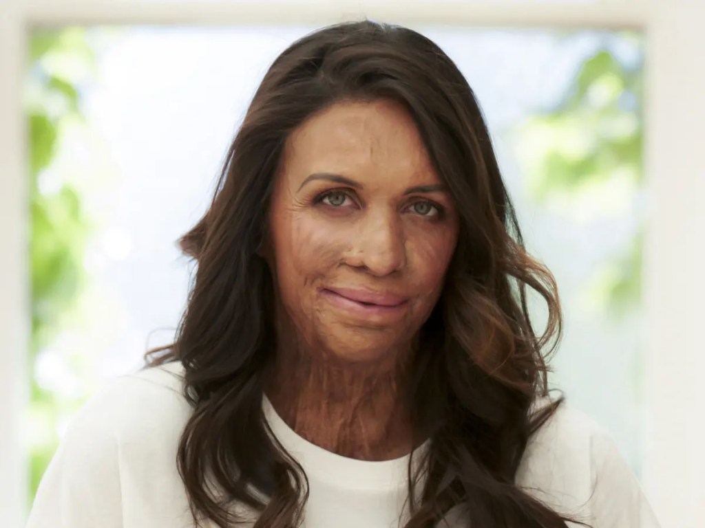Turia Pitt FINAL